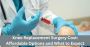 Knee Replacement Surgery Cost: Affordable Options