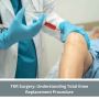 TKR Surgery: Understanding Total Knee Replacement Procedure