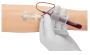 Reliable Vaku 8+ Safety Blood Collection Set – Order Now