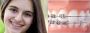  How to Care for Your Braces