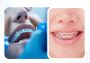  The Ultimate Guide to Invisalign Clear Aligners in Jaipur