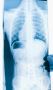 Chiropractic Services Alpharetta, GA Chiropractic Services Alpharetta, GA