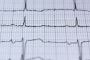 Cost of Ekg | Acaweb.com