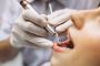 Professional Teeth Cleaning at Active Dental Frisco