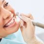 Keep Your Smile Bright with Professional Teeth Cleaning!