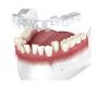 Is Invisalign Painful?