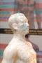 Acupuncture for Oncology North York