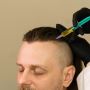 Restore Your Hair Naturally with PRP Therapy at Evoke Hair &