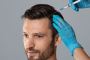 GFC vs. PRP Therapy: The Best Hair Restoration Treatment in 