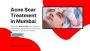 Acne Treatment In Mumbai
