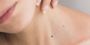 Fingernail Lifting: Symptoms, Prevention, and Home Treatment