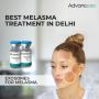 Exosomes for Melasma & Anti-Aging: Transformative Skincare