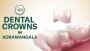 Restore Your Smile with Dental Crowns in Koramangala!