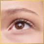 Eyelid Surgery