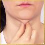 Chin Liposuction & Neck Skin Tightening in Los Angeles