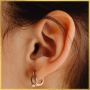 Otoplasty in Los Angeles