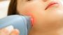 Get glowing Skin with Laser Skin Tightening Treatment