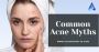 Common Acne Myths | Aiconic Health