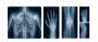 Choose the Best Radiology Imaging Services from AI TELERADIO