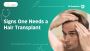  Exploring the Possibilities of Hair Transplantation