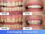 Top Smile Designing Clinic in Vile Parle, Mumbai | AK Dental