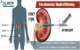 Percutaneous nephrolithotomy cost in India