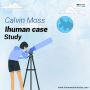 Calvin Moss iHuman Case Study