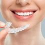 Invisalign Treatment Surrey