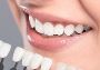 Veneers Surrey BC
