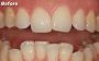 Expert Toddler Dental Care at Clarity Dental Expert Toddler Dental Care at Clarity Dental
