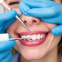Discover the Difference Between Teeth Cleaning and Whitening