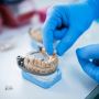 Affordable Dental Bridges in Allen, TX 