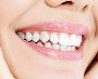Affordable Smile Restoration with Dental Implants