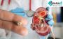 Kidney Stone Specialist in Ludhiana | Anand Homeo