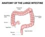 Effective Colon Cleanse at Andrea's Place Colonics