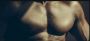 Gynecomastia Surgery New York – Regain Your Confidence
