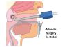 Adenoid surgery in Dubai | Dr Mustafa Kapadia