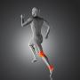 Bad Signs After ACL Surgery? Dr Rik Kundra