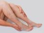 Spider Vein treatment in Sharjah