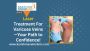 Varicose veins laser treatment in pune