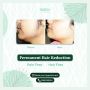 Laser Hair Reduction Treatment in Bangalore: Anew