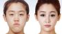 Best Plastic Surgery Clinic In Korea