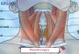 Thyroid Surgery in India – Expert Thyroid Treatment with Edh