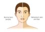 Discover a holistic approach to jaundice treatment at Nirvan