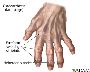 Embrace Natural Healing: Expert Naturopathy for Osteoarthrit