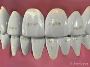 Healthy Dental Practices for Every Kid with Braces
