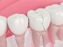 Why Baby Teeth are Important?
