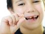 Tips to Prevent Cavity Formation