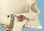 Temporo Mandibular Joint In Doha