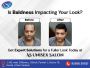 Say Goodbye to Baldness with Natural Hair Patch in Noida 